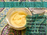 belly butter for stretch marks